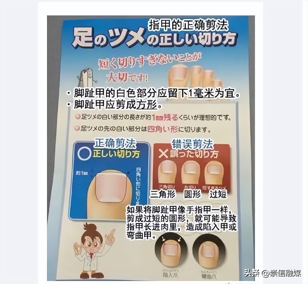 甲沟炎剪指甲太疼了,甲沟炎指甲剪了但是超级疼怎么办