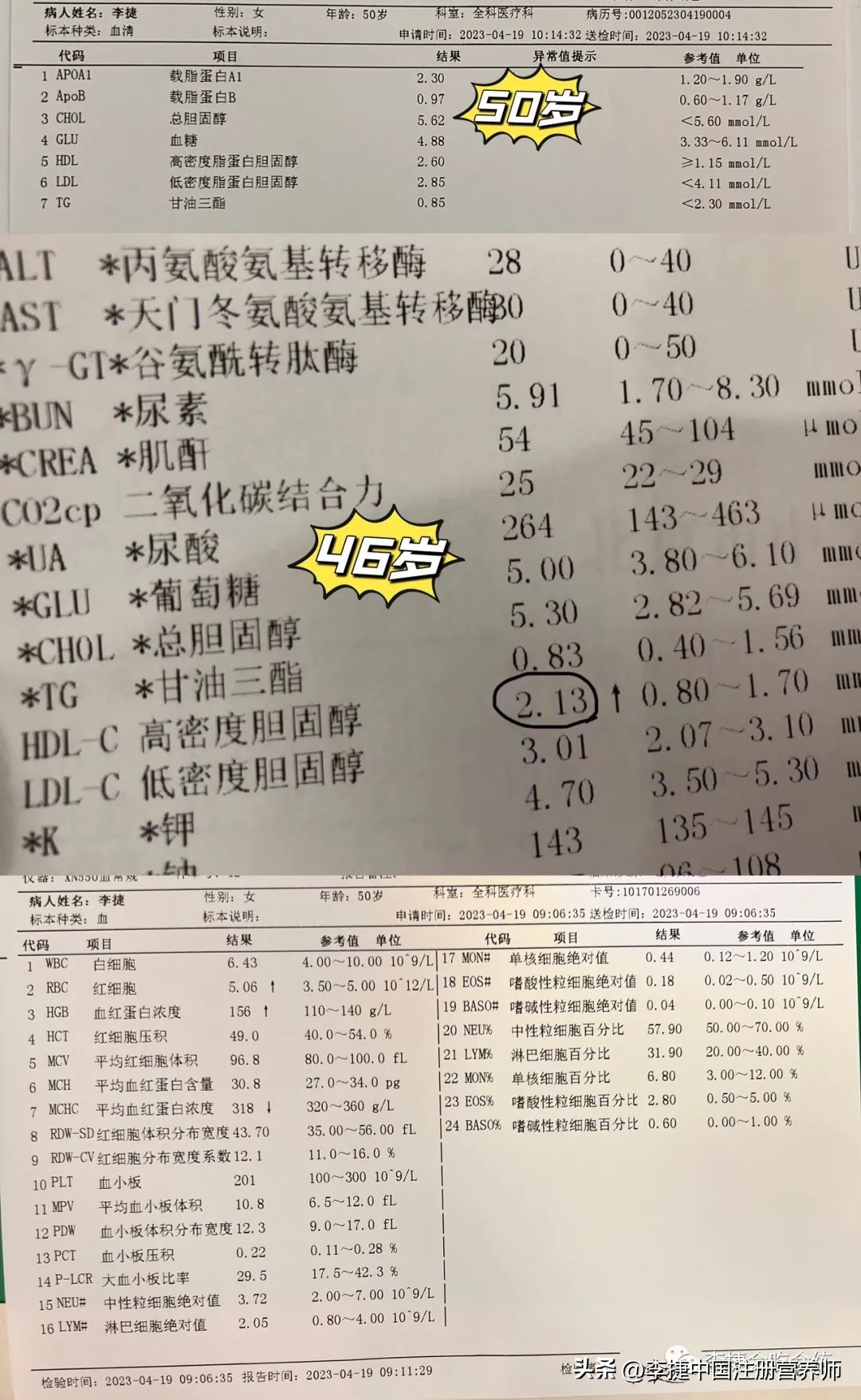 如何提高高密度脂蛋白胆固醇数值,如何才能提高高密度脂蛋白胆固醇