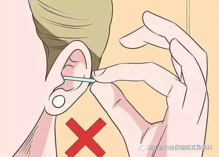 耳朵游泳进水了怎么办,游泳耳朵进水像堵了一层膜听不清