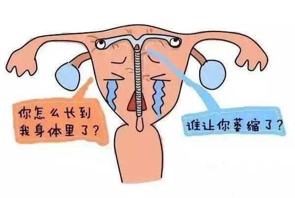 节育器能进入羊膜腔内吗,节育环把子宫穿孔