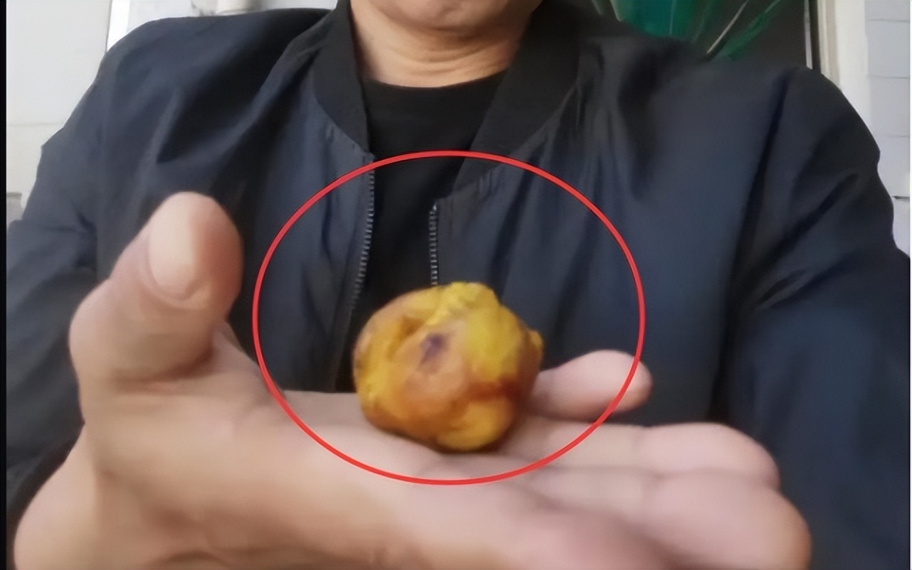 一颗结石,一颗鸡宝能卖多少钱