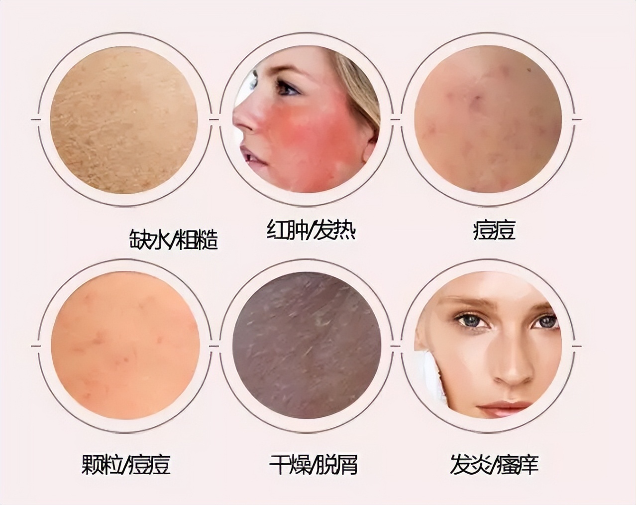 脸部过敏怎么快速好起来啊,一招解决脸部过敏