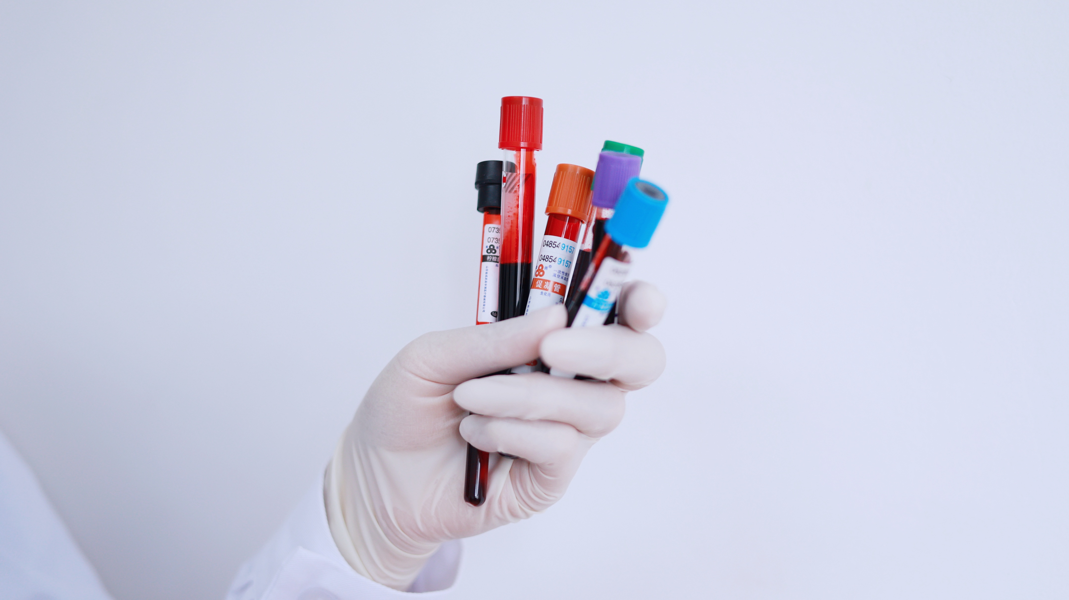 检查甲功三项空腹和不空腹的区别,空腹和不空腹检查肝功能有啥区别