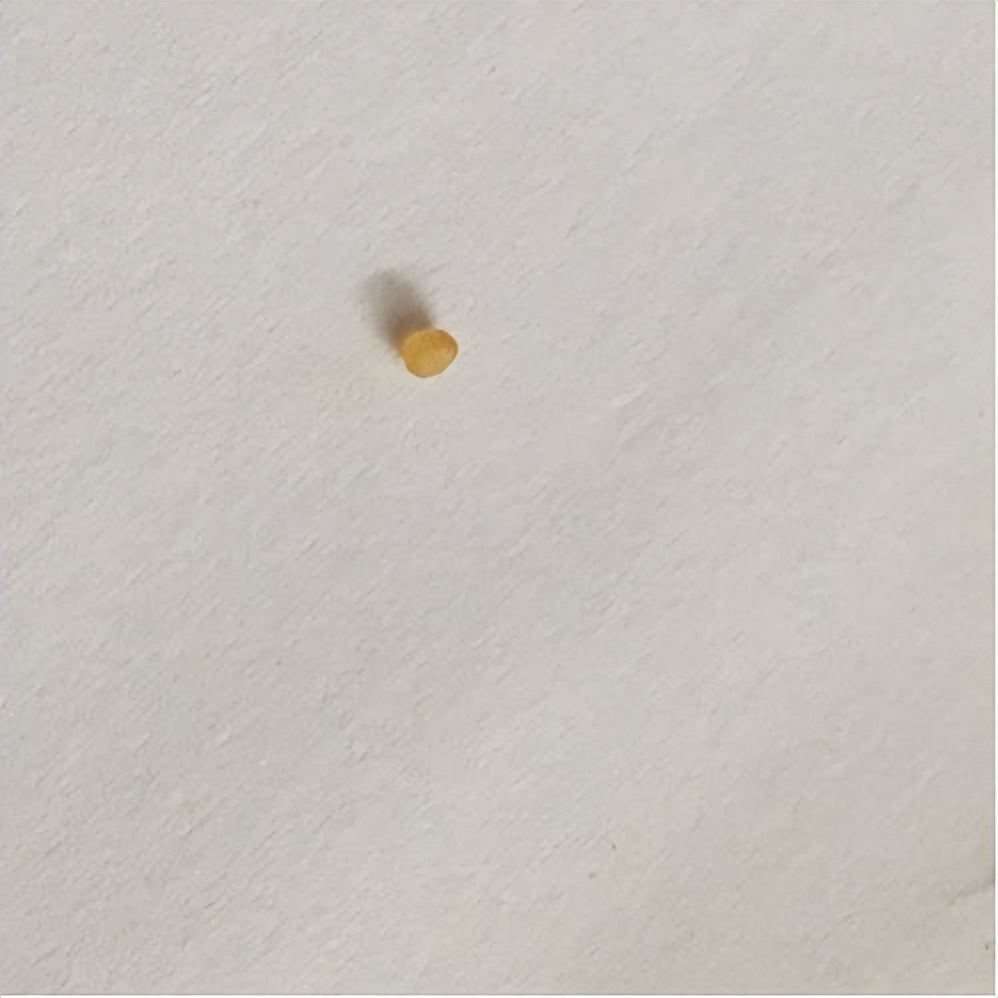 鼻子黑头挤出水一样的液体,鼻子挤黑头粉刺