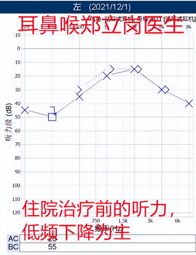 突然耳聋堵塞是怎么回事,耳朵痒听力下降有堵塞感