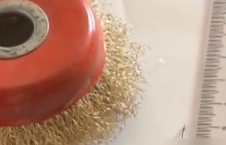 17岁男孩头痛被送进医院，医生一看X光片直接傻眼：没救了