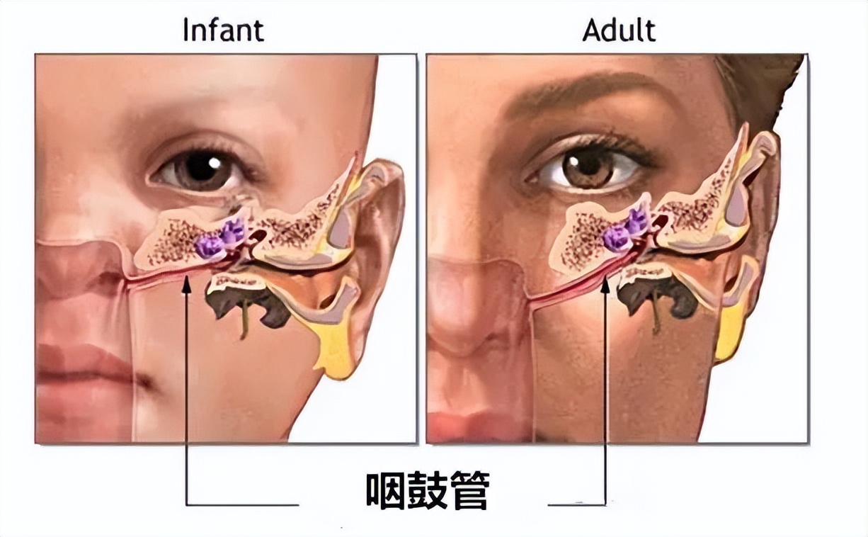 6个月宝宝听力不敏感长大会好吗,宝宝听力重度有没有可能听力正常