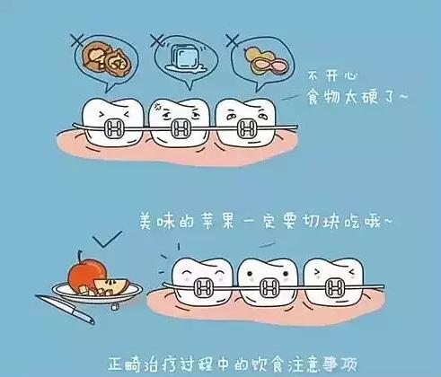 正畸治疗须知,正畸有哪些注意事项