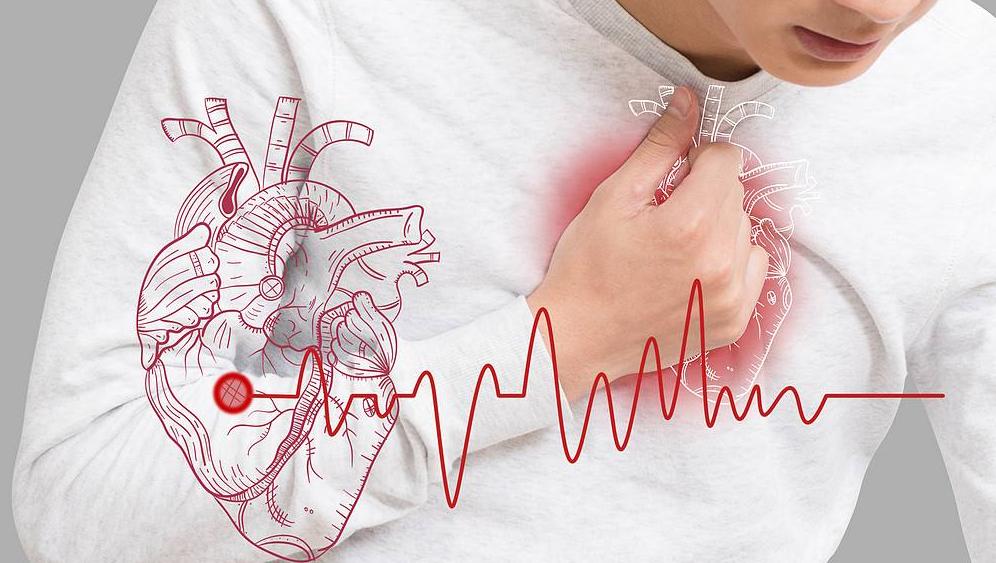 心梗急救药有吗,心梗急救用救心丸还是硝酸甘油