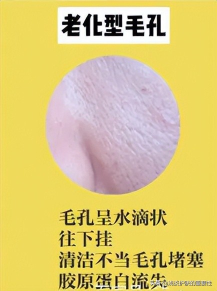 男人脸上毛孔粗大用什么护肤品,男人脸上毛孔粗大用什么护肤品好