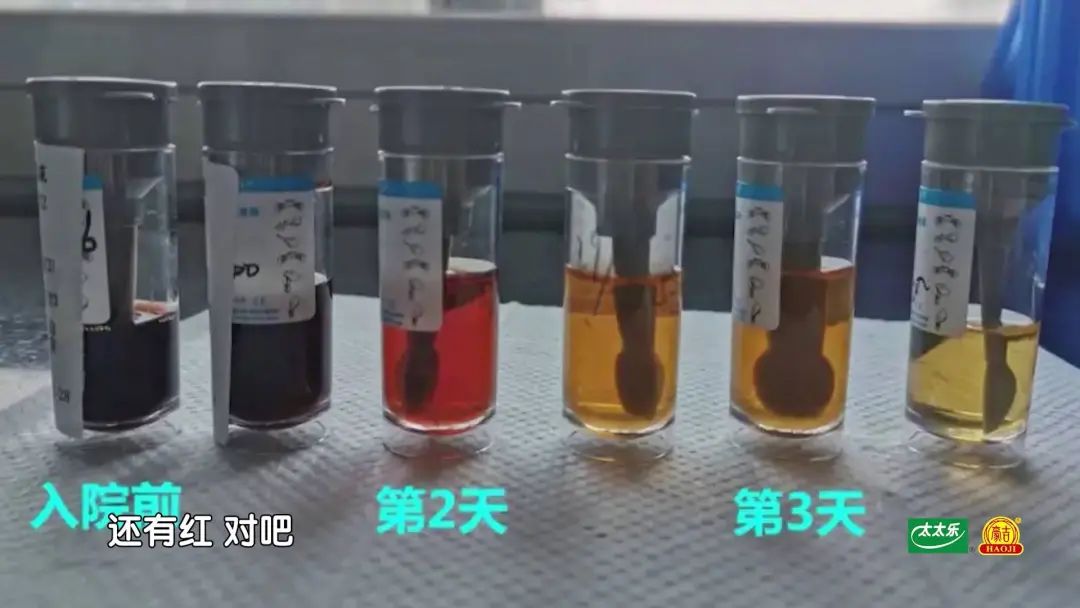 “沉默的杀手”，一发现很可能是晚期，教你3招，抓住早期病变的蛛丝马迹