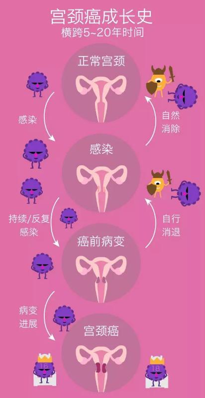 除了HPV，妇科炎症也会引起宫颈癌？
