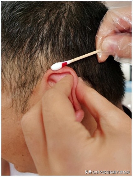 儿童颈部淋巴结怎么消除,放疗能消除颈部淋巴结吗