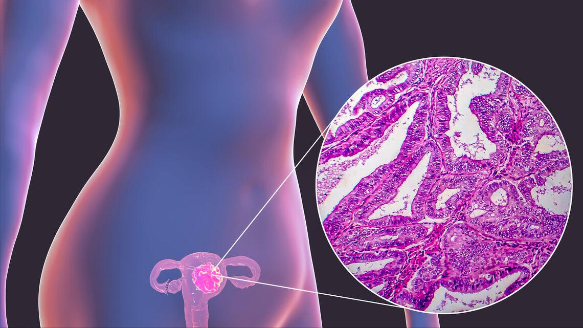 派特灵治妇科,派特灵生物讲解