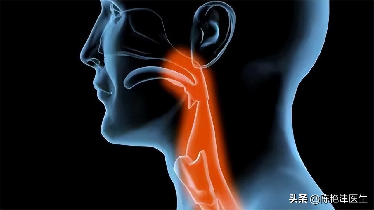 咽炎查出食管癌,以为是慢性咽炎却是食管癌