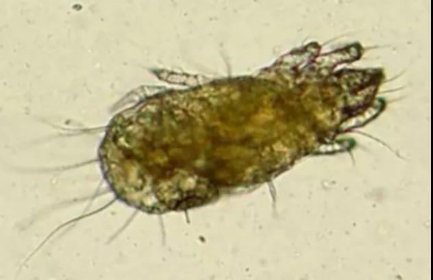 螨虫有活螨和死螨吗,真假红蜘蛛