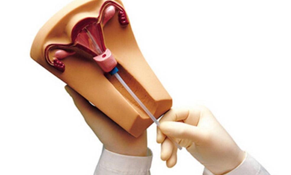 这种避孕方式，一劳永逸，为何外国人都在用，国内却少有人用？