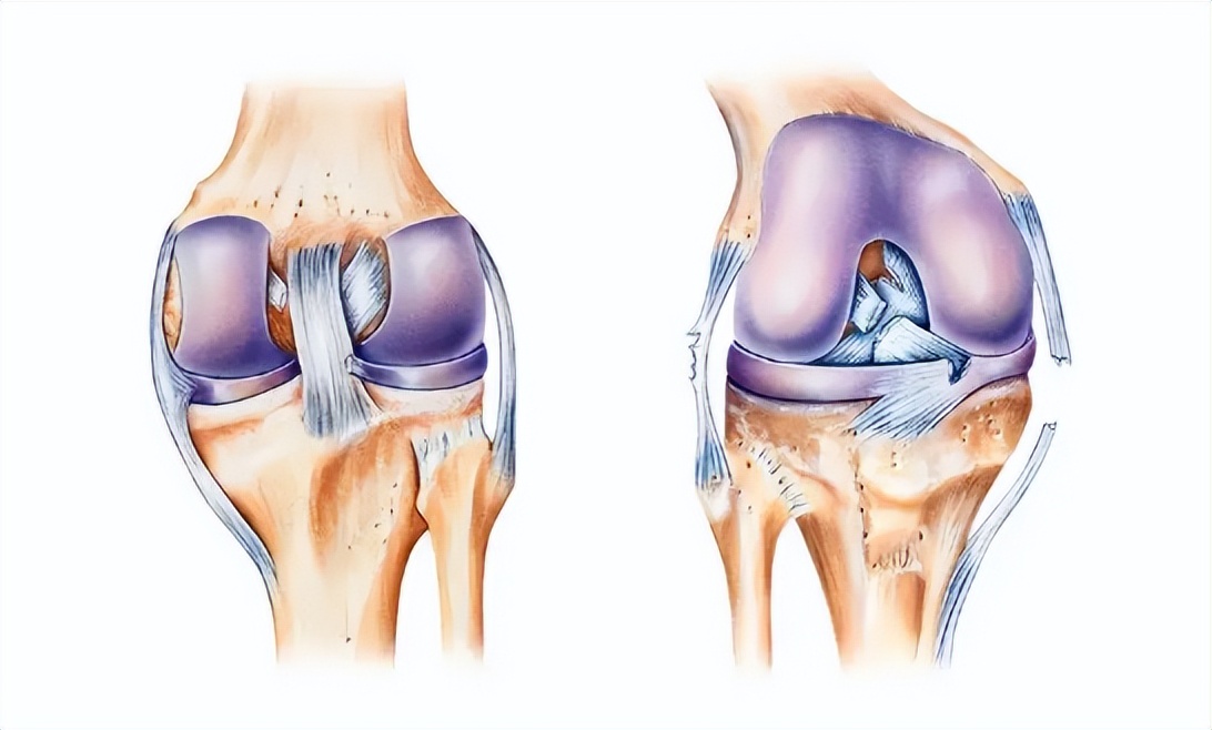 膝关节韧带损伤的最佳治疗方法,左膝关节前交叉韧带损伤症状