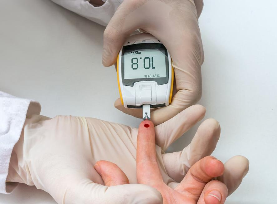 口干舌燥但又不想喝水是什么原因,为什么人会经常觉得口干