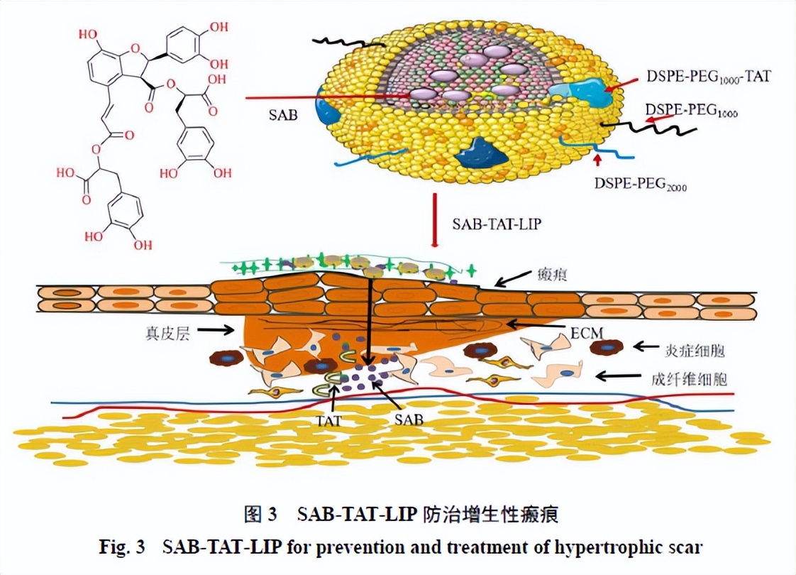 研究出阻止纤维化的药物,瘢痕疙瘩研究进展