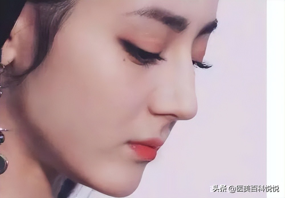 江苏苏王——如何让侧脸变得好看？你的侧脸合格了吗？