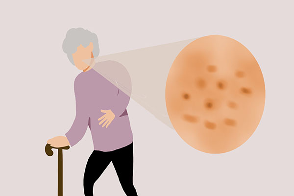 这6种疾病不能治愈,注意这四种病目前根本无法治愈