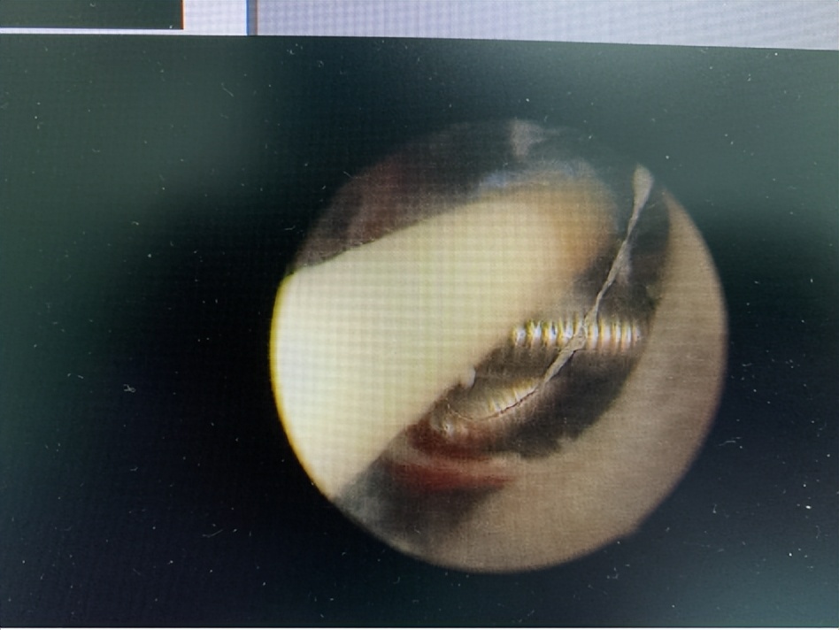 我的体内有一个地球,我的体内有个地球