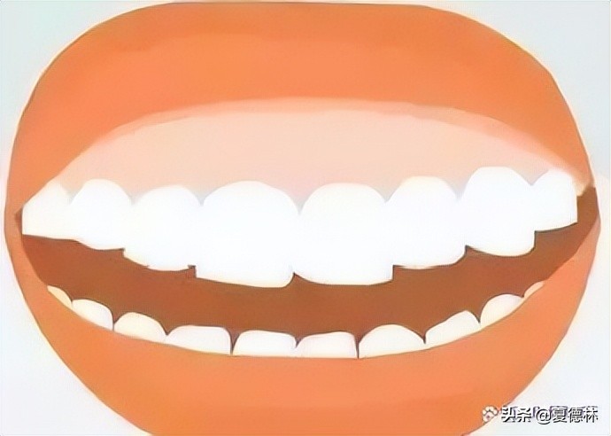 笑起来露牙龈的很难看怎么改善,笑起来不好看露牙龈怎么办