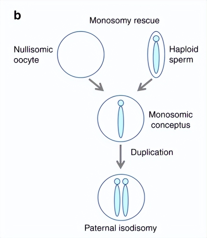 试管婴儿pgt-a检测结果怎么看,试管婴儿不孕不育基因检测