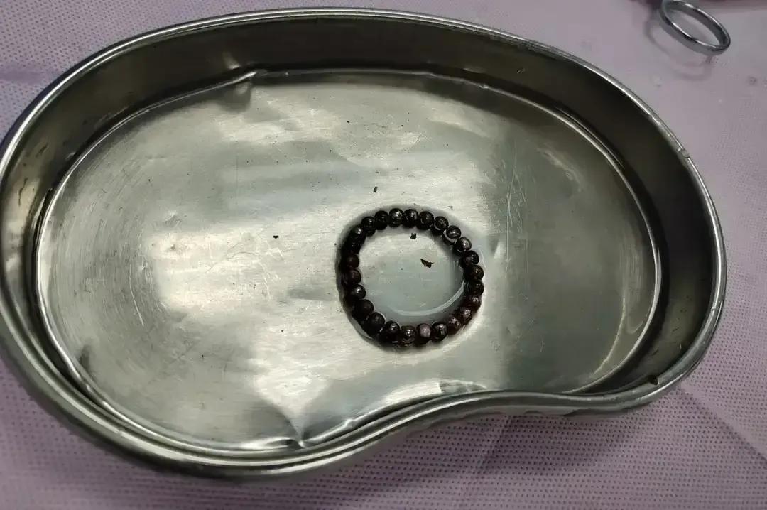 湖南长沙一男子玩太嗨，25颗磁力珠塞尿道，差点“自宫”取异物