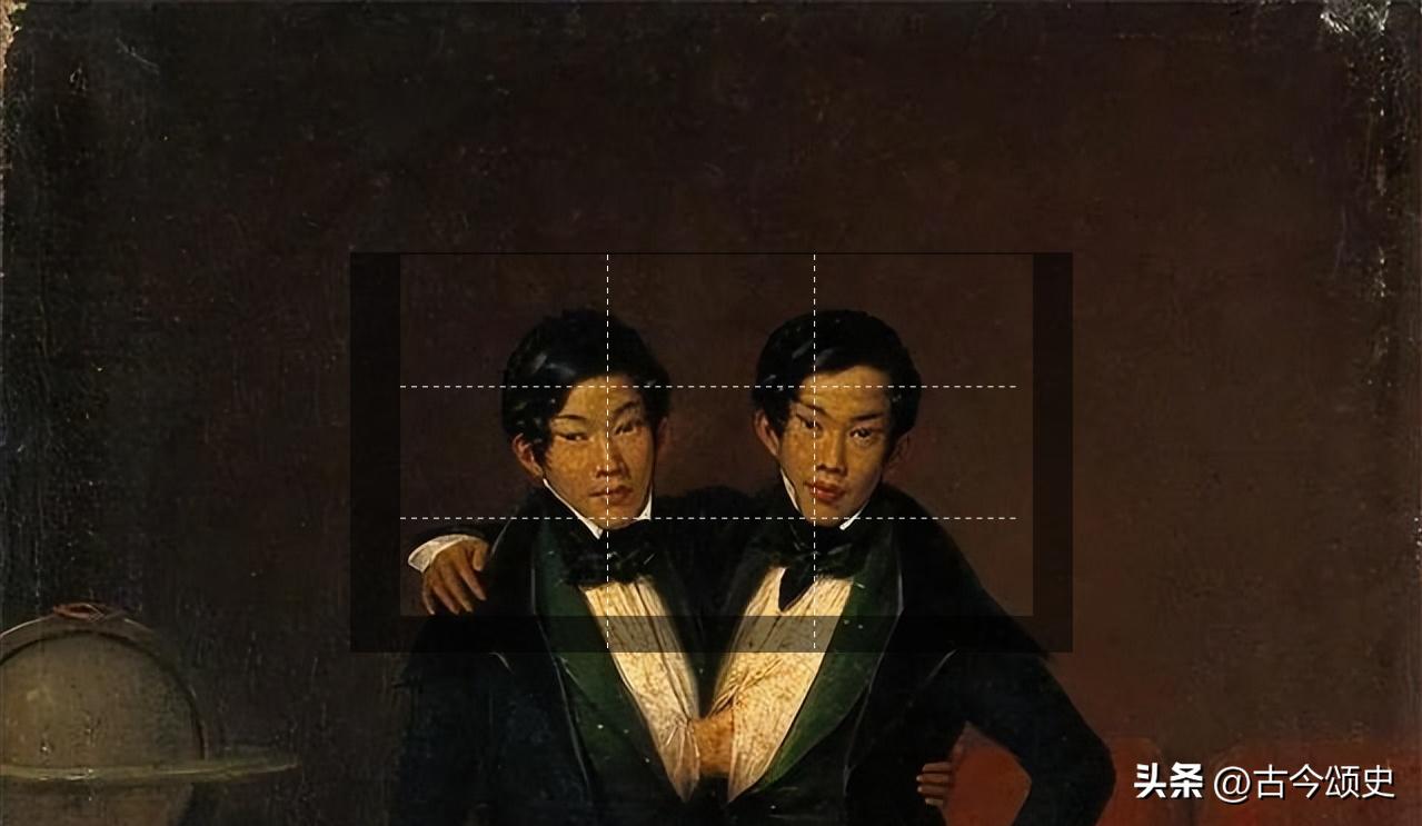 连体人结婚生子,连体人如何生子