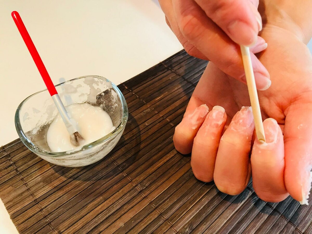 指甲渐变有条纹怎么解决,指甲薄有竖纹容易开裂不易长出来