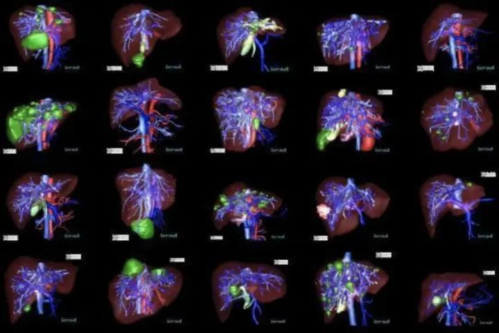 目标检测数据集采集,目标检测图像数据集