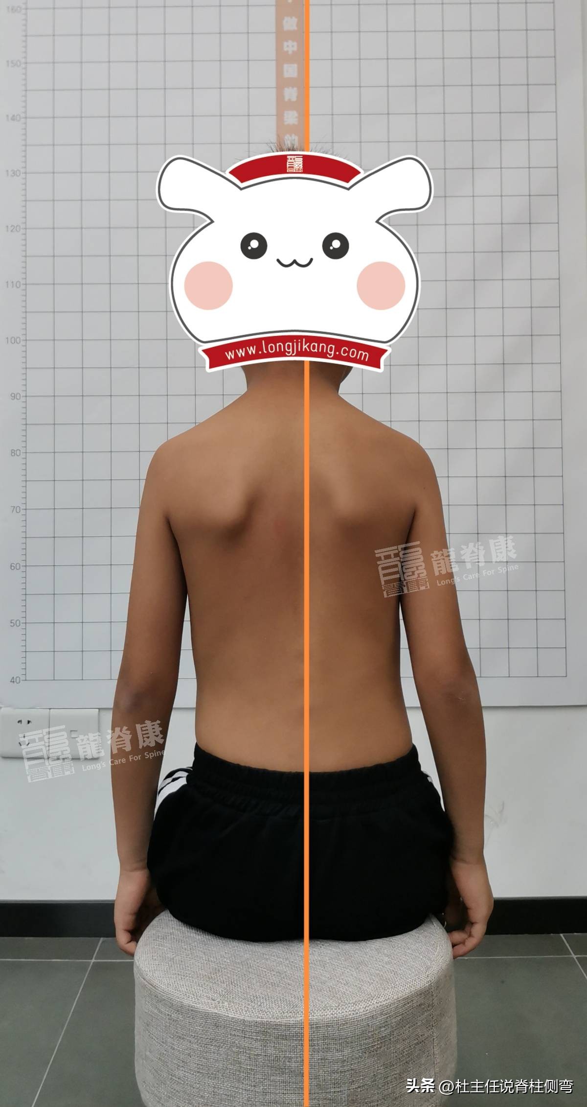 孩子含胸驼背怎么矫正,孩子含胸驼背矫正方法每天10分钟