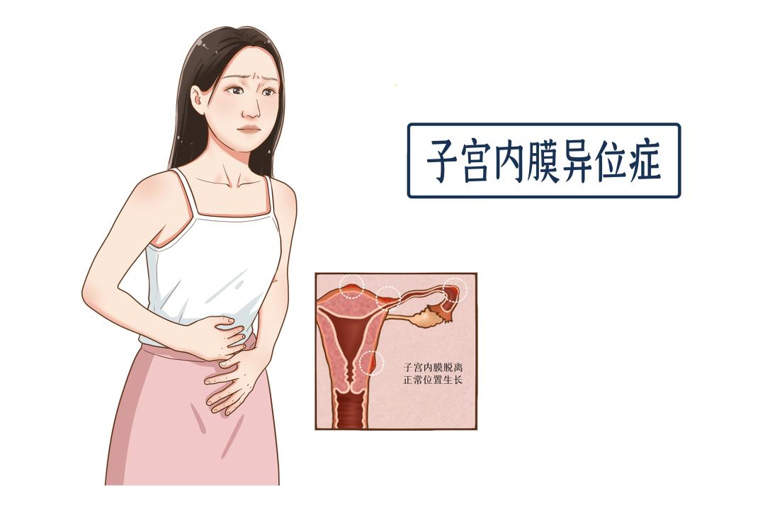 生个孩子就能“治好”？这究竟是个什么病