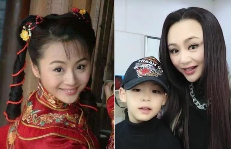 明星脸部僵硬的图片,很多明星脸僵是怎么回事