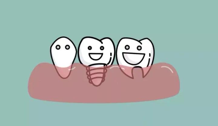 种植牙拔了做矫正,种植牙齿全过程真相大揭秘