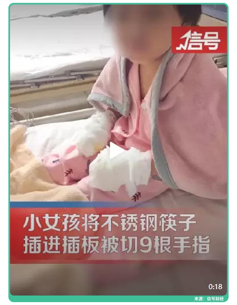 三岁女童玩筷子导致双手被锯,四岁女童不锈钢筷子切掉9根手指