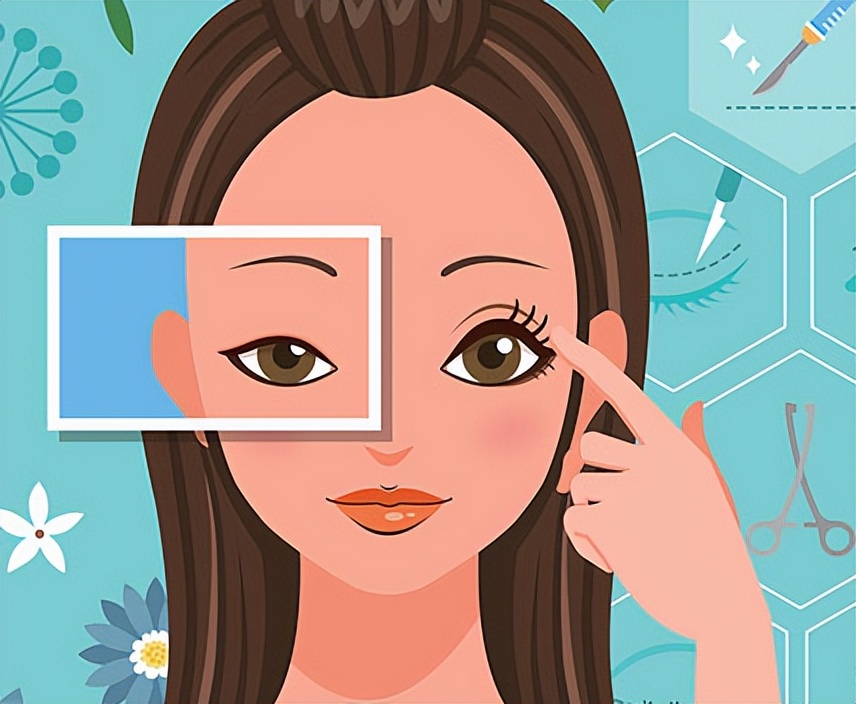 双眼皮怎么做又省钱又好看,做双眼皮的10个常识