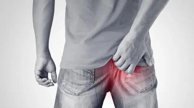 肛门最常见的疾病有哪些,肛门常见疾病及症状