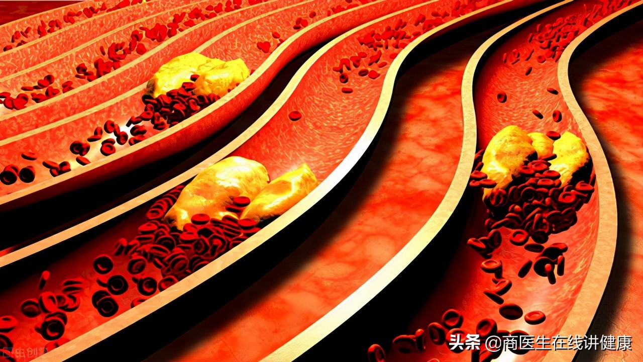 有的人得了糖尿病为啥一辈子没事,得了糖尿病是不是一生就完了