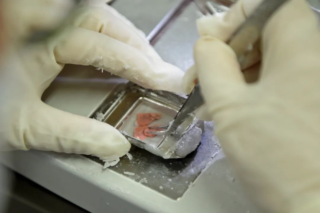 医生说病理报告有点小问题,病理报告没出来好害怕啊