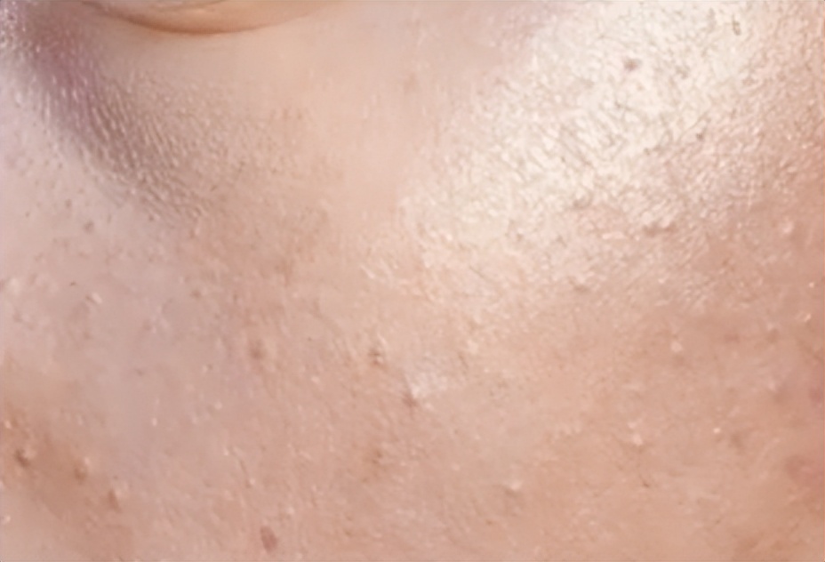 你的脸为什么总是洗不干净,总感觉自己的脸洗不干净怎么办