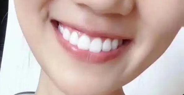 如何快速解决牙黄不用牙膏,怎么去黄牙最快最有效妙招