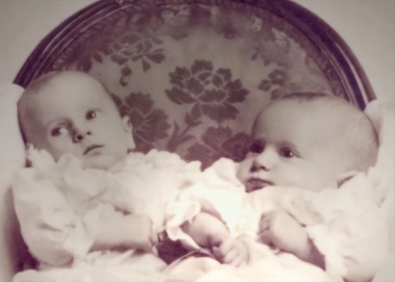 连体人一方死亡怎么办？妹妹去世后，连体姐姐被迫跟遗骸共同生活