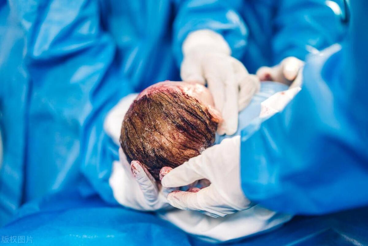 剖宫产后如何快速恢复调理身体,剖宫产术后怎么恢复最快