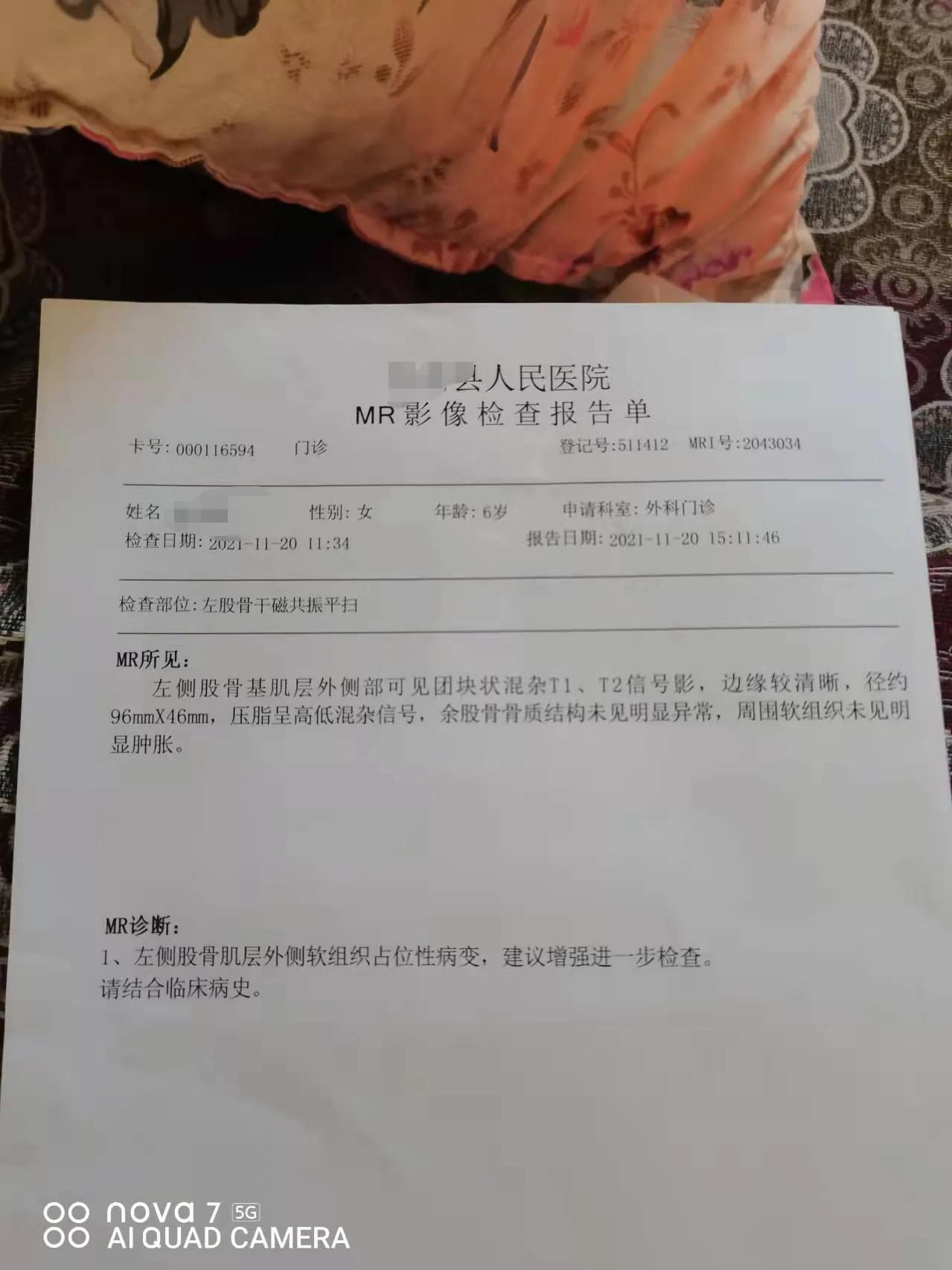 下肢血肿中医怎么治疗,小儿面部血肿消除最快方法
