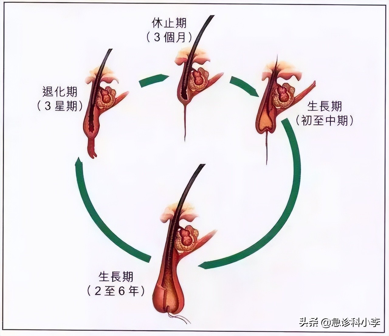 经常染发会致癌医生忠告注意5点,多久染发一次不会致癌