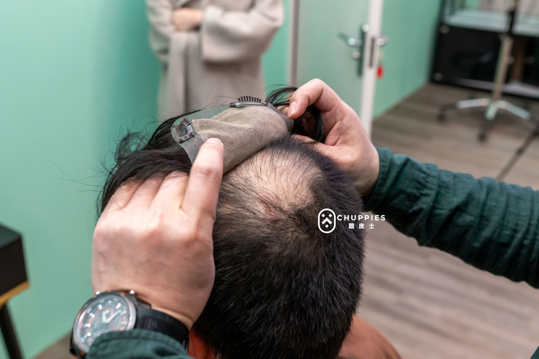 后脑勺扁塌适合的假发,戴假发显头塌怎么办