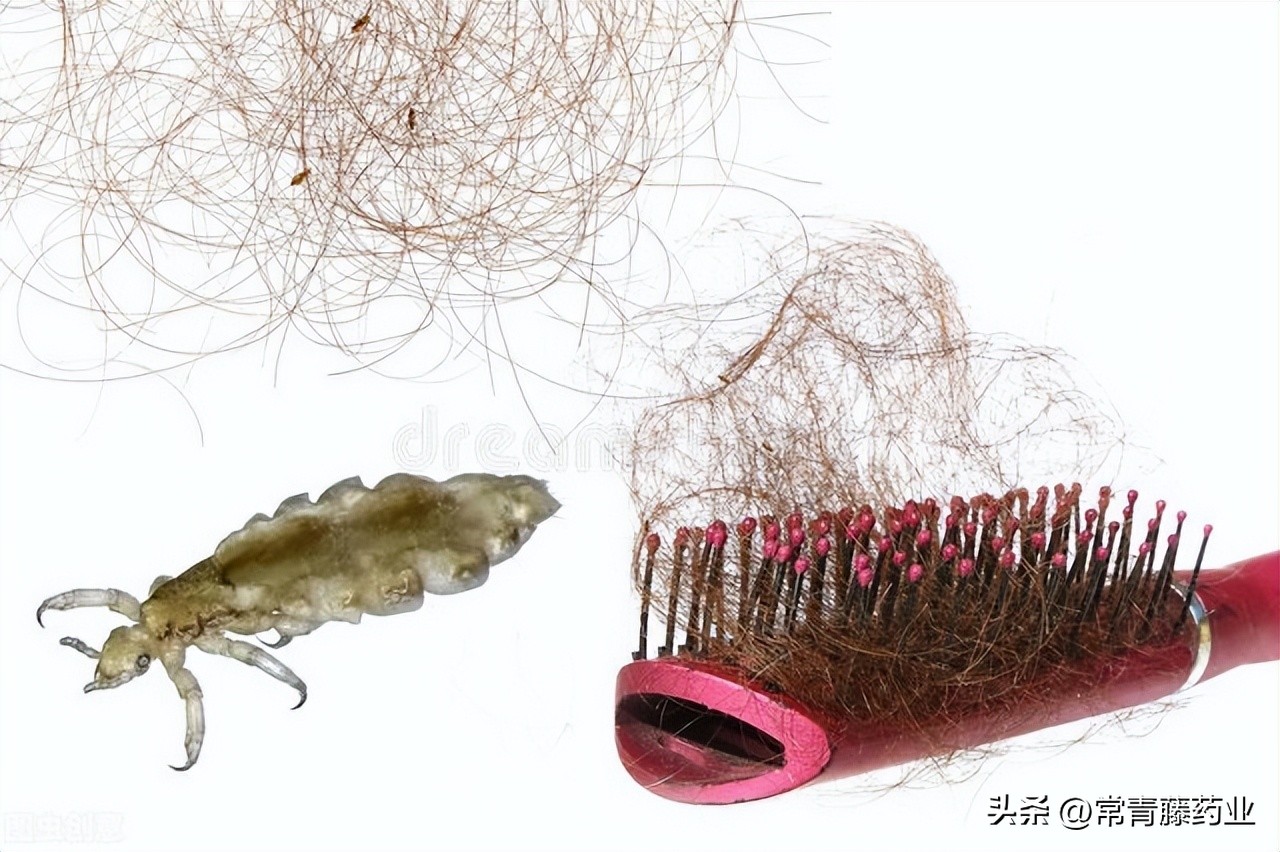 虱子与我们共存千万年，头上长虱子是啥感觉？有什么办法治疗？